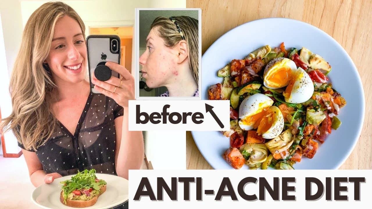 What to Eat (and What to Avoid) for Clearer Skin